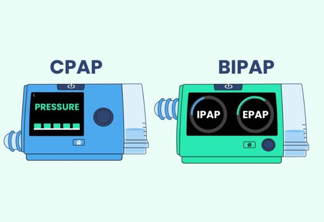 CPAP vs BiPAP