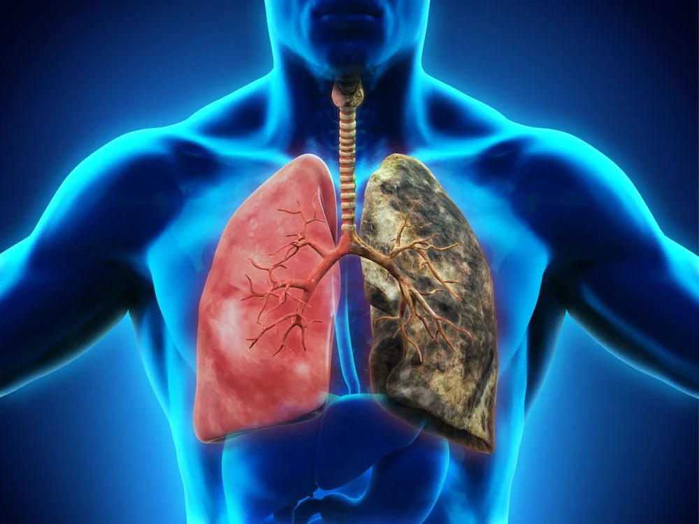 COPD Symptoms Stage 1: Early Signs and What to Do