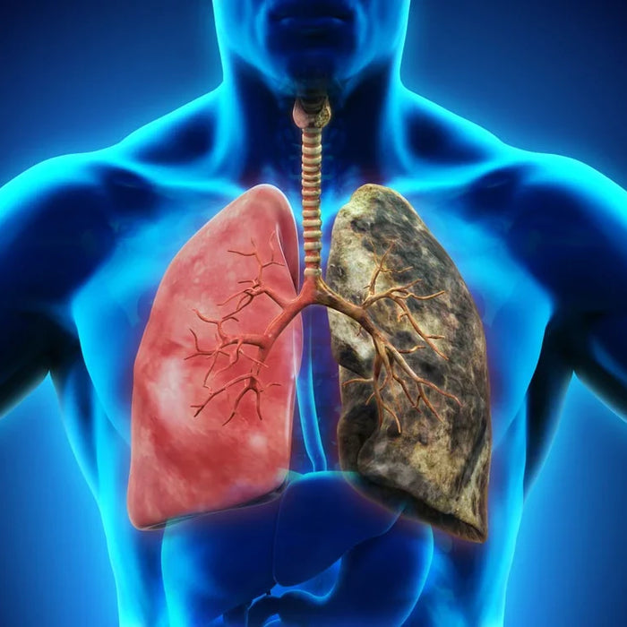 COPD Symptoms Stage 1: Early Signs and What to Do